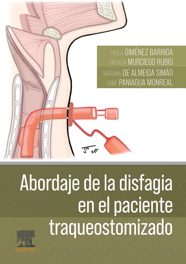 ABORDAJE DE LA DISFAGIA EN EL PACIENTE TRAQUEOSTOMIZADO - 1