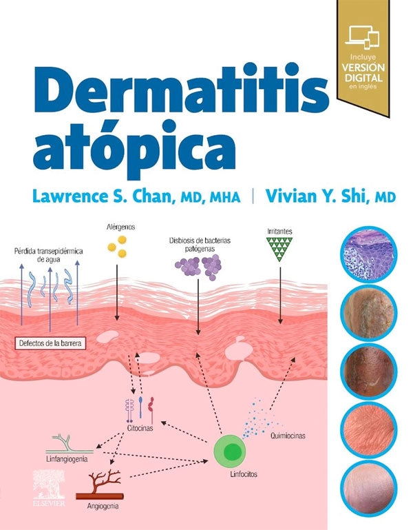 DERMATITIS ATOPICA - 1