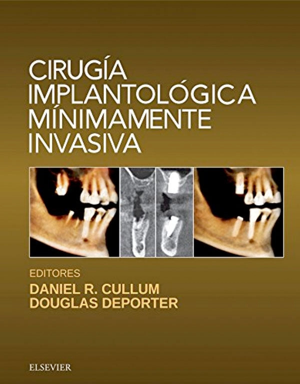 CIRUGIA IMPLANTOLOGICA MINIMAMENTE INVASIVA - 1