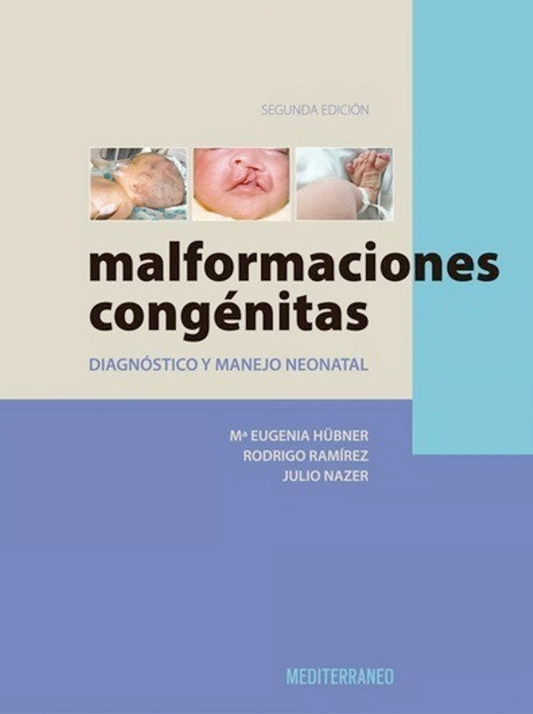MALFORMACIONES CONGE NITAS 2ª ED. - 1