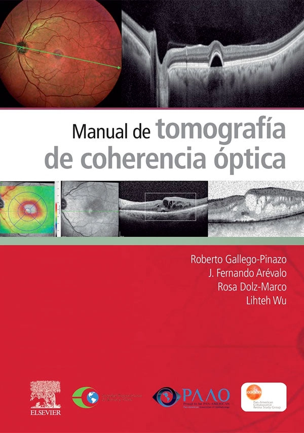 MANUAL DE TOMOGRAFIA DE COHERENCIA OPTICA - 1
