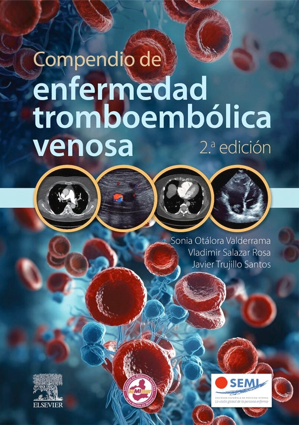 COMPENDIO DE ENFERMEDAD TROMBOEMBOLICA VENOSA 2ª ED. - 1