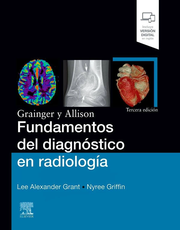 FUNDAMENTOS DEL DIAGNOSTICO EN RADIOLOGIA 3ED. - 1