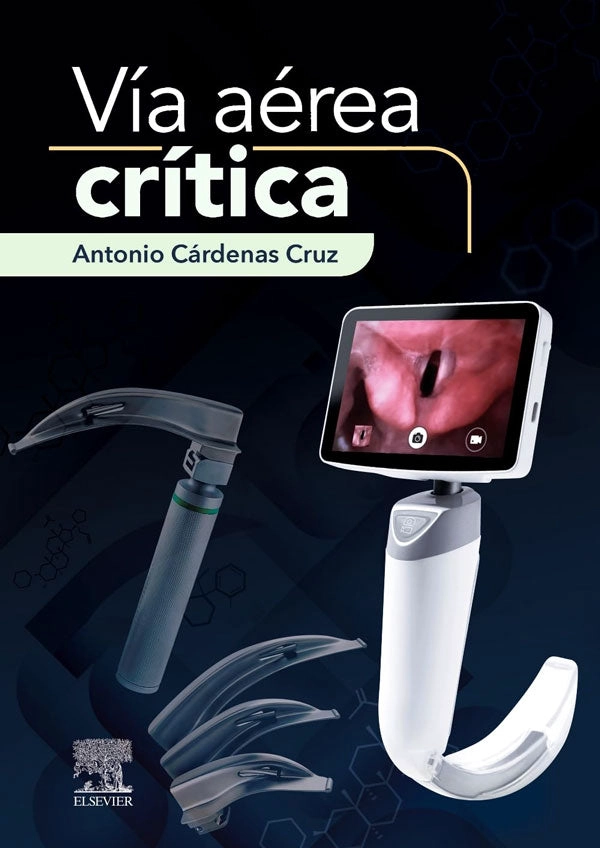 VIA AEREA CRITICA - 1