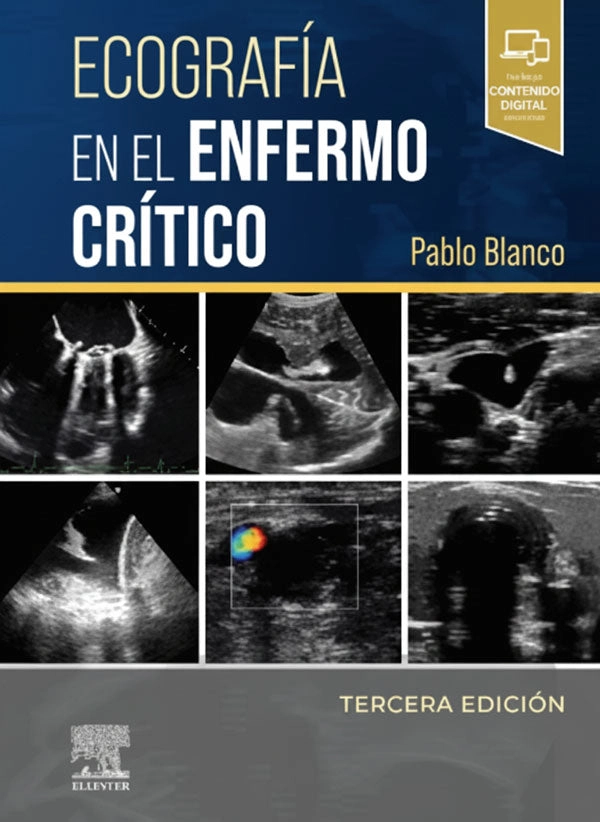 ECOGRAFIA EN EL ENFERMO CRITICO 3ED. - 1