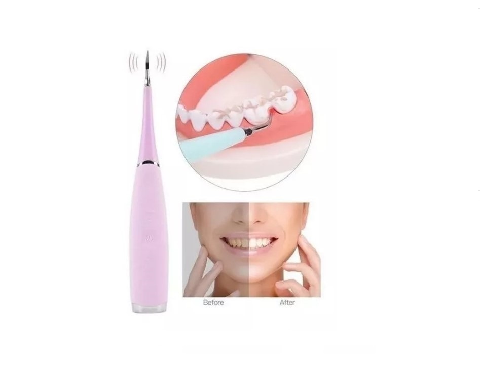 LIMPIADOR DE DIENTES ELECTRICO REMOVEDOR DE SARRO RECARGABLE - 1