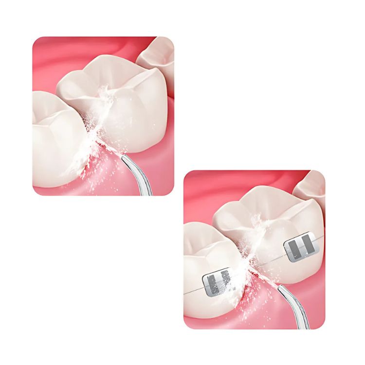 LIMPIADOR DENTAL PORTATIL USB IRRIGADOR BUCAL - 6