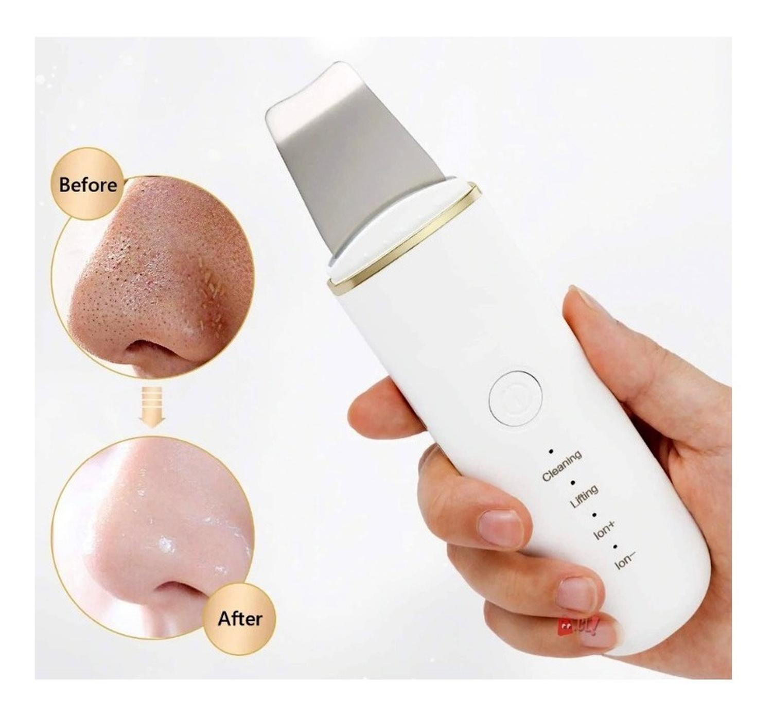 LIMPIADOR PUNTOSTORE ULTRASÓNICO FACIAL LIFTING PS - 3