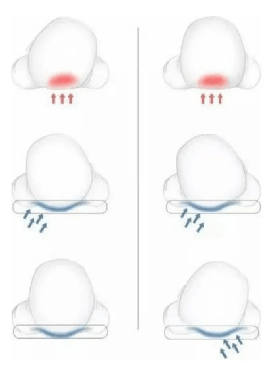 ALMOHADA COJÍN ANTI-PLAGIOCEFALIA PARA BEBÉ - 4