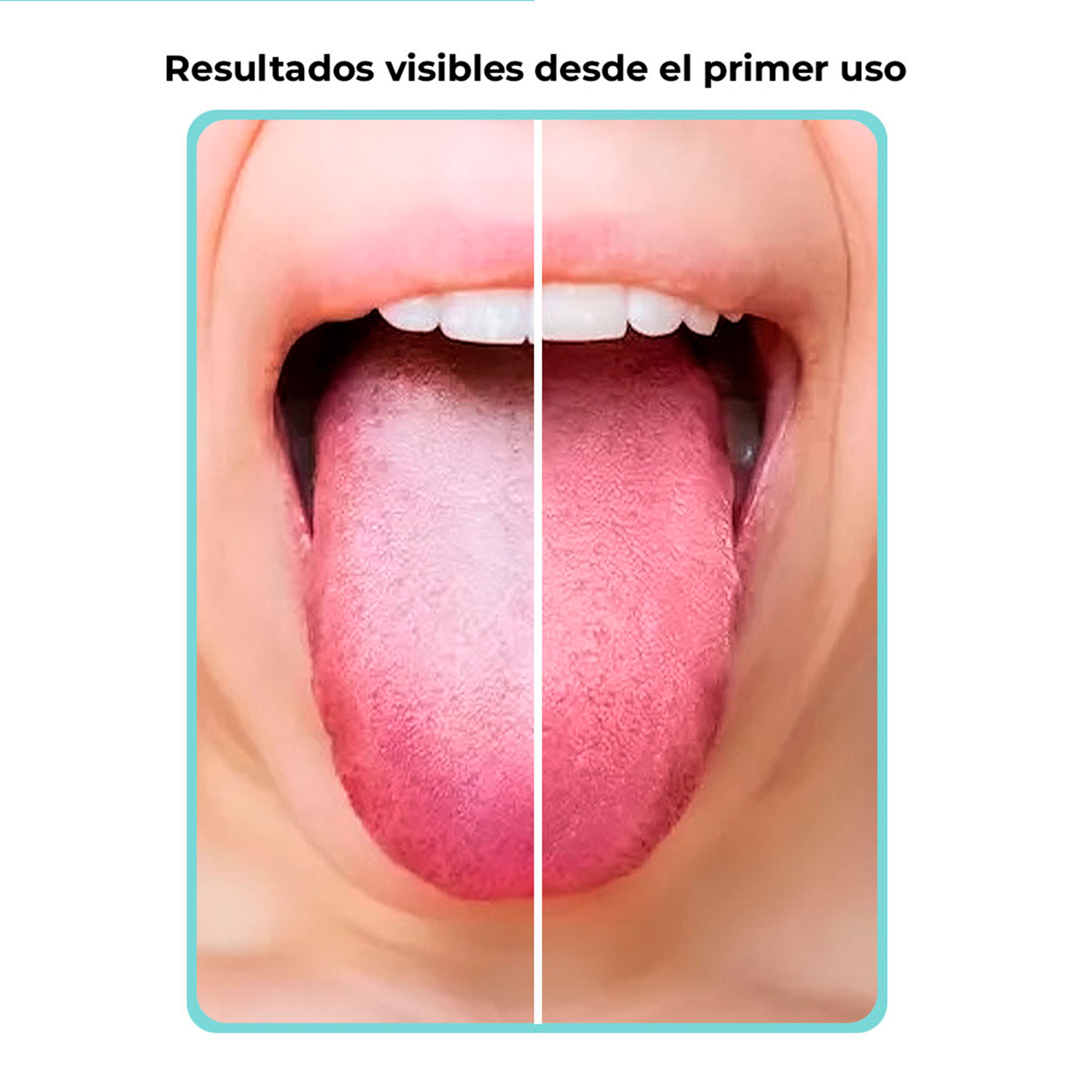 LIMPIADOR DE LENGUA DE ACERO INOXIDABLE CUIDADO BUCAL BOCA - 4