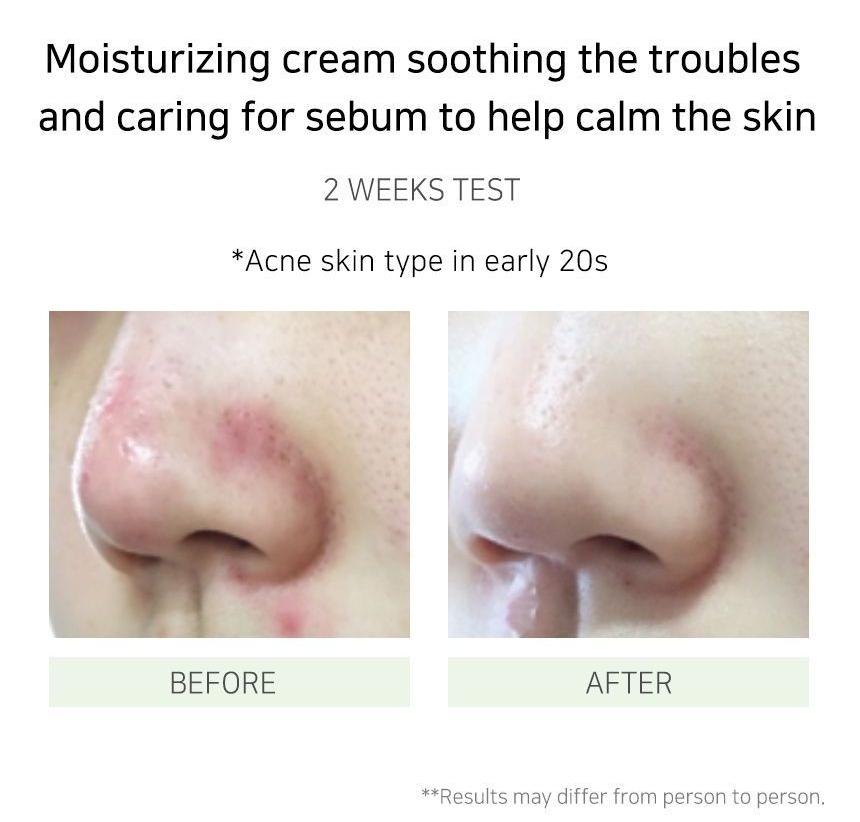 CREMA DE SOLUCIÓN CALMANTE / POROS PARA PIELES GRASAS / MIXTAS - COSMÉTICA COREANA VEGANA - 5