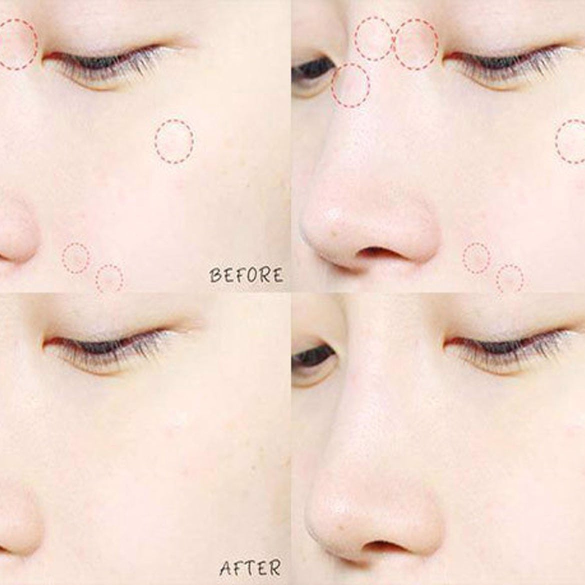 PARCHES ANTI ACNÉ SEE & SAW CLEAR SPOT PATCH - COSMÉTICA COREANA - 4