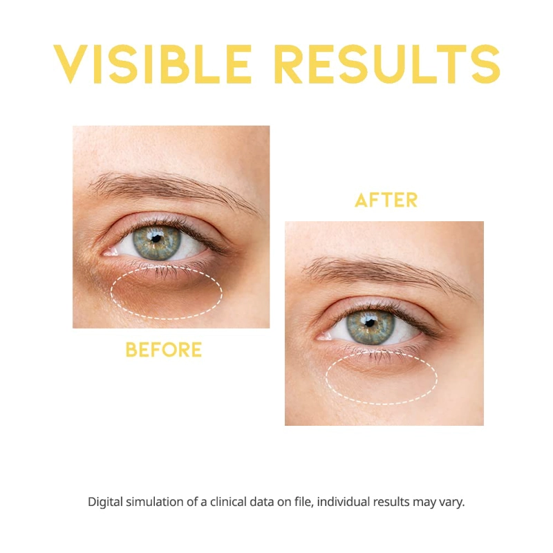 SERUM CONTORNO OJOS REDUCE LAS OJERAS - 4