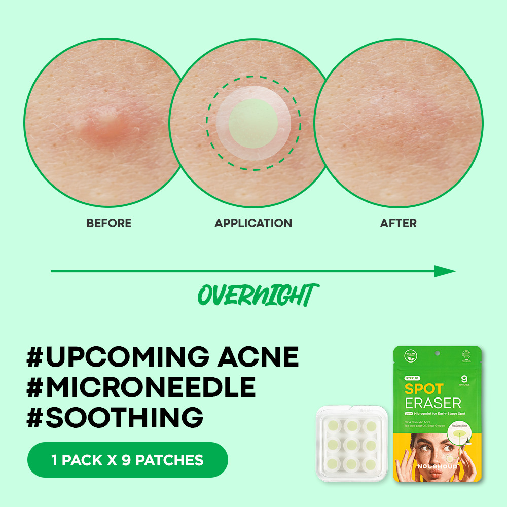 PARCHES ANTIACNE  - COSME TICOS COREANOS - 2