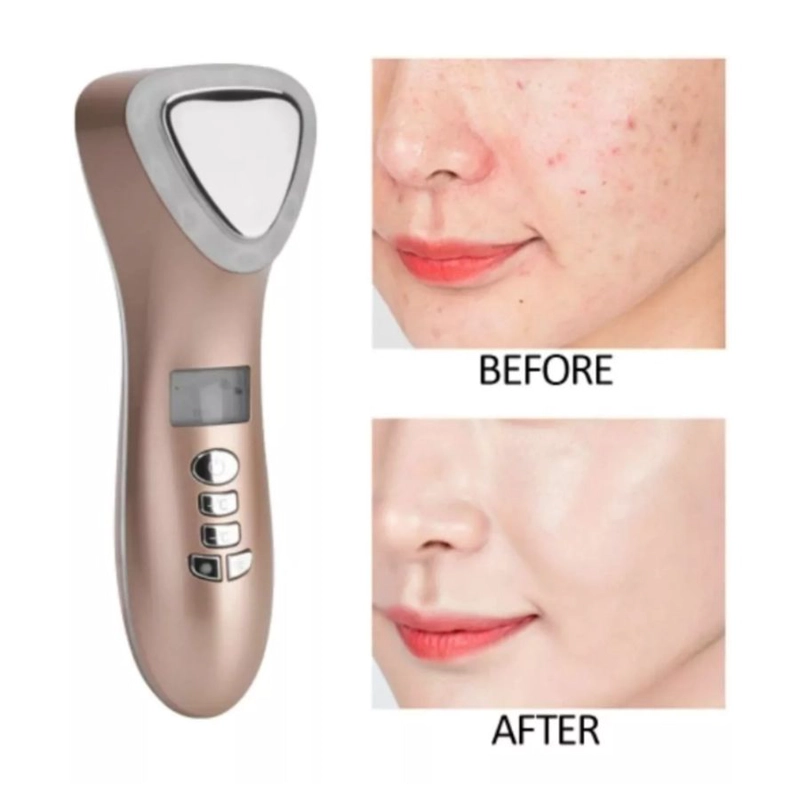 MAQUINA CRIOTERAPIA ULTRASÓNICA CLICK VENTAS PLÁSTICO ABS LIMPIADOR FACIAL FRIOCALOR - 2