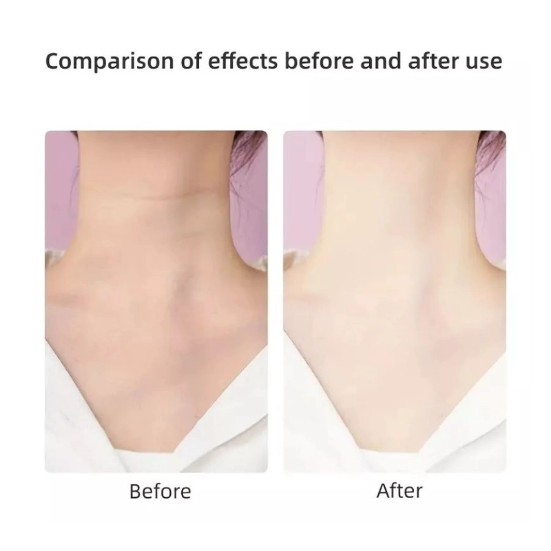 MASAJEADOR CLICK VENTAS REJUVENECEDOR FACIAL CUELLO CON VIBRACIÓN - 4