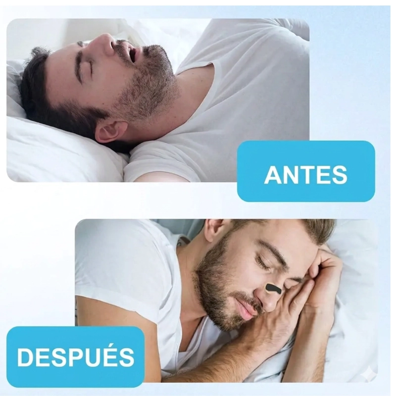 DILATADOR NASAL ANTI RONQUIDOS KIT DE INICIO 15 DIAS - 5