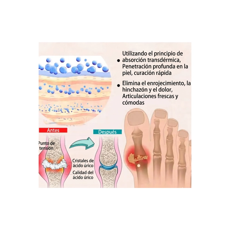 PARCHE PARA ARTRITIS METABOLICA Y DOLOR DE JUANETES - 12 UNIDADES - 2