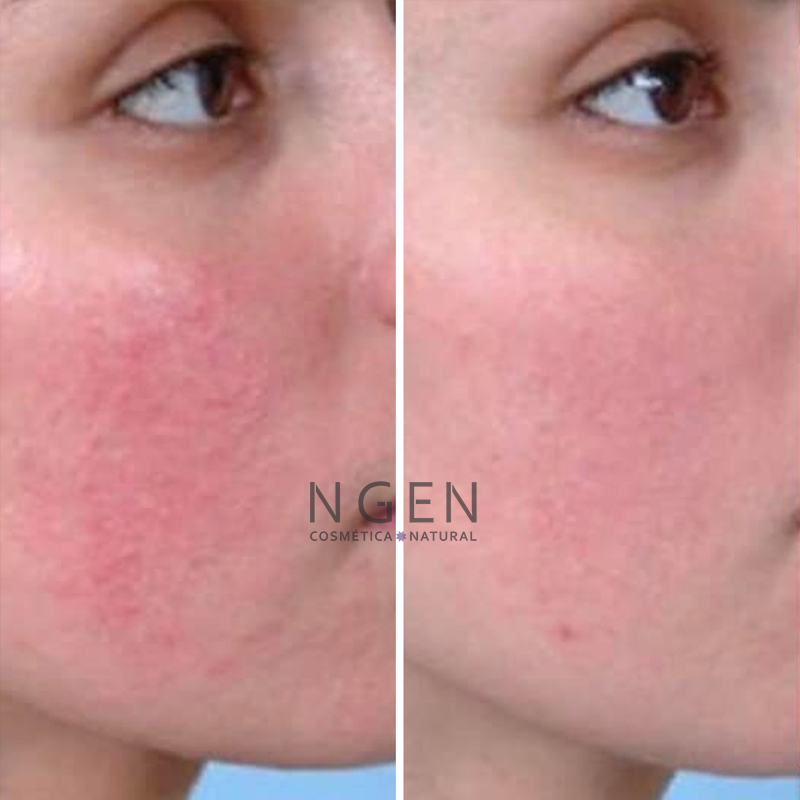 CREMA FACIAL ROSTRO Y CUELLO NGEN 100 ML ANTIROJECES CALMANTE E HIDRATANTE - 2