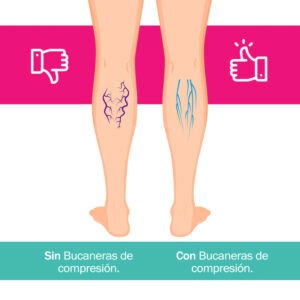 BUCANERAS COMPRESION PERRITOS | COMODIDAD Y ESTILO - 7