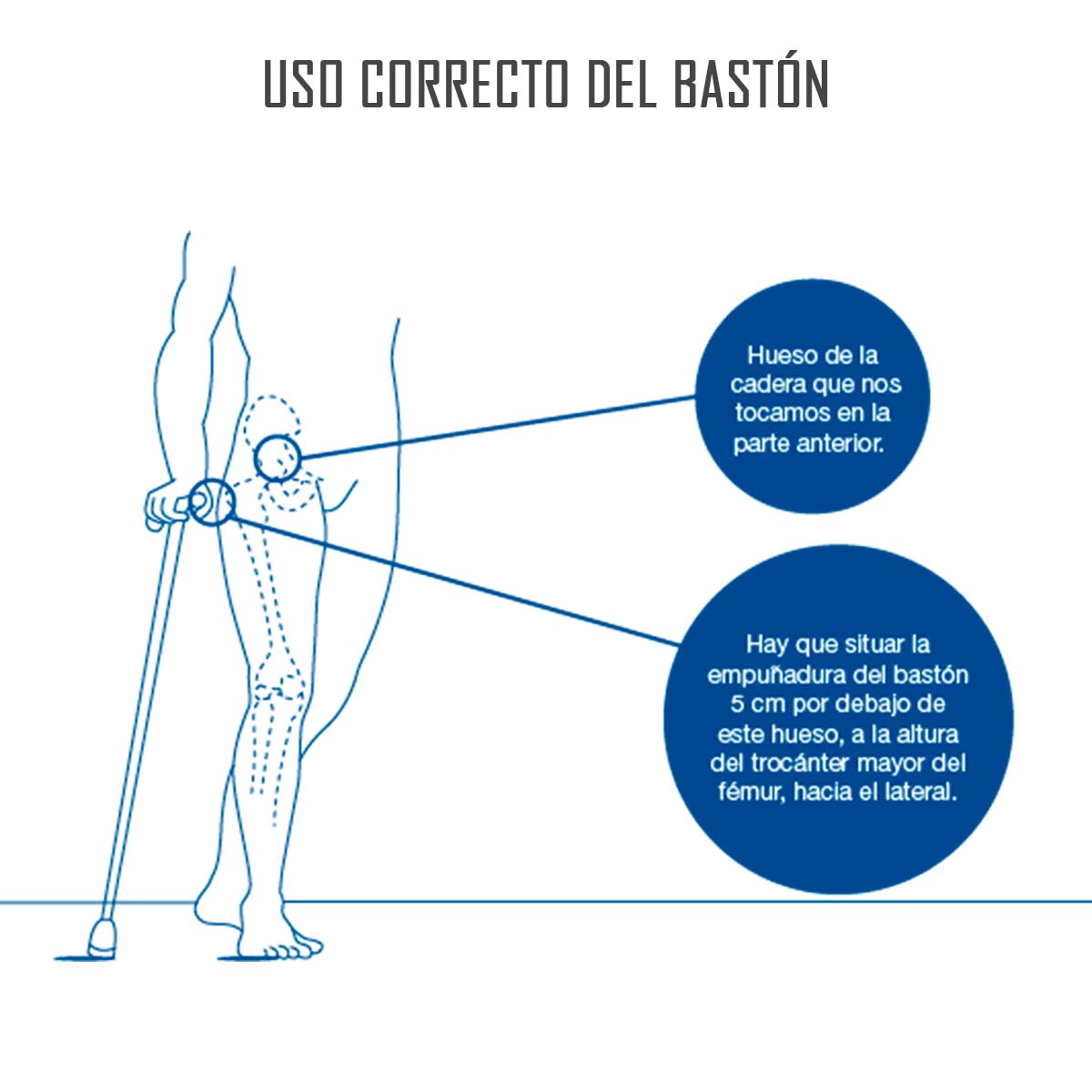 BASTÓN PLEGABLE ORTOPÉDICO DE BRONCE REGULABLE EN ALTURA MANGO T - 5