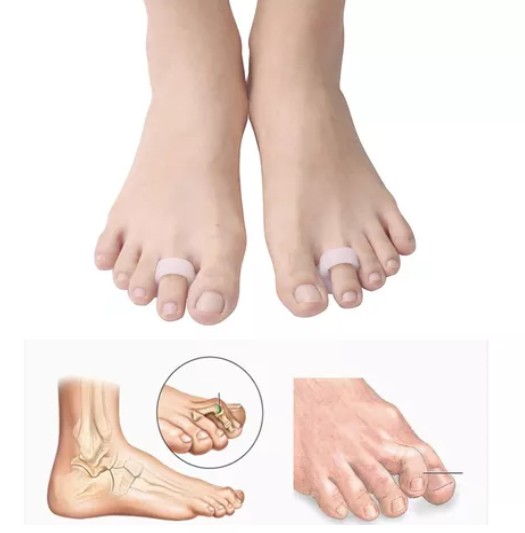 ALMOHADILLA CORRECTOR SILICONA DEDO MARTILLO O GARRA - 3