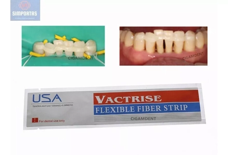 BANDA DE REFUERZO DENTAL TIRA DE FIBRA TIPO RIBBOND CALIDAD - 1