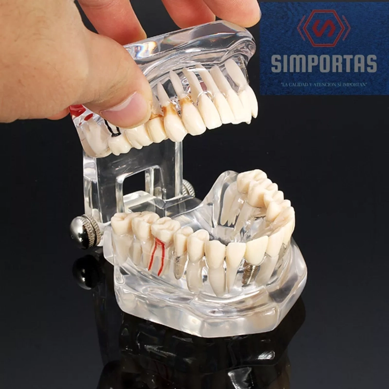 MODELO DENTAL ENSEÑANZA Y TRATAMIENTOS IMPLANTES PROTESIS - 1