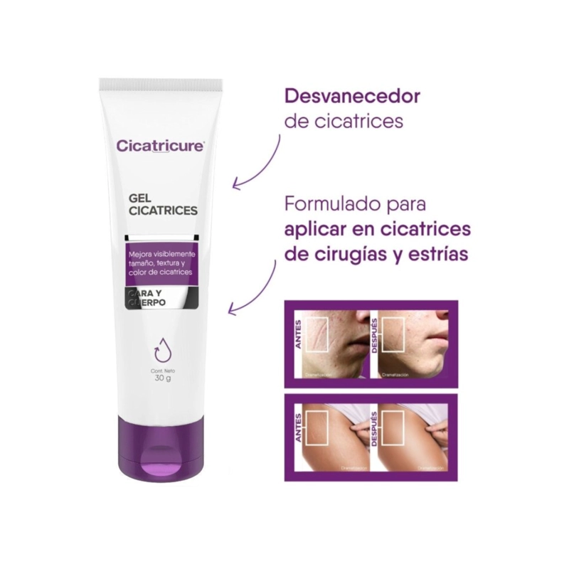 CICATRICURE GEL CICATRICES Y ESTRIAS 30 G - 6