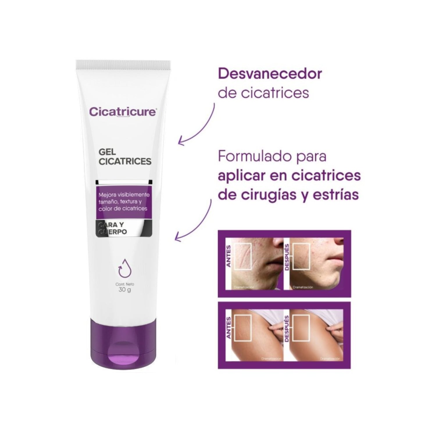 CICATRICURE GEL CICATRICES Y ESTRIAS 30 G - 6