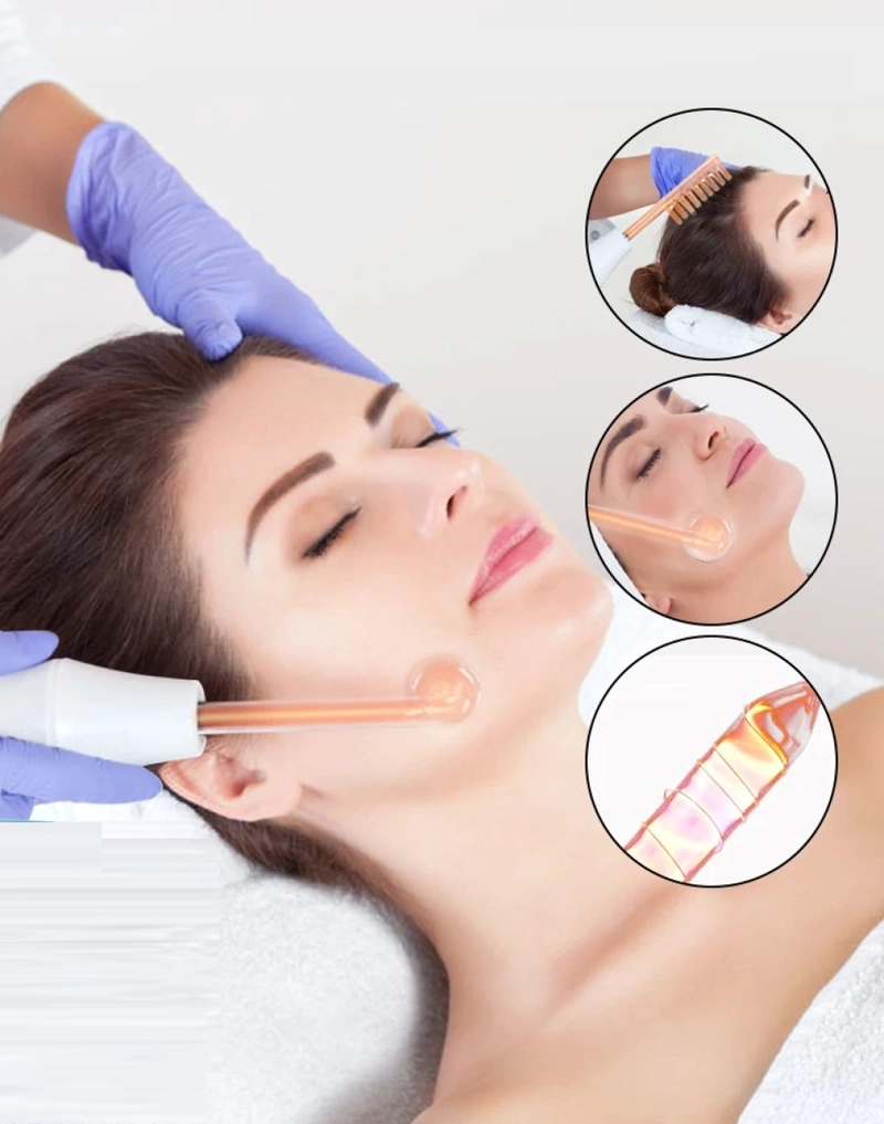 MAQUINA REMOVEDOR MANCHA PORTATIL ALTA FRECUENCIA FACIAL LAU - 5