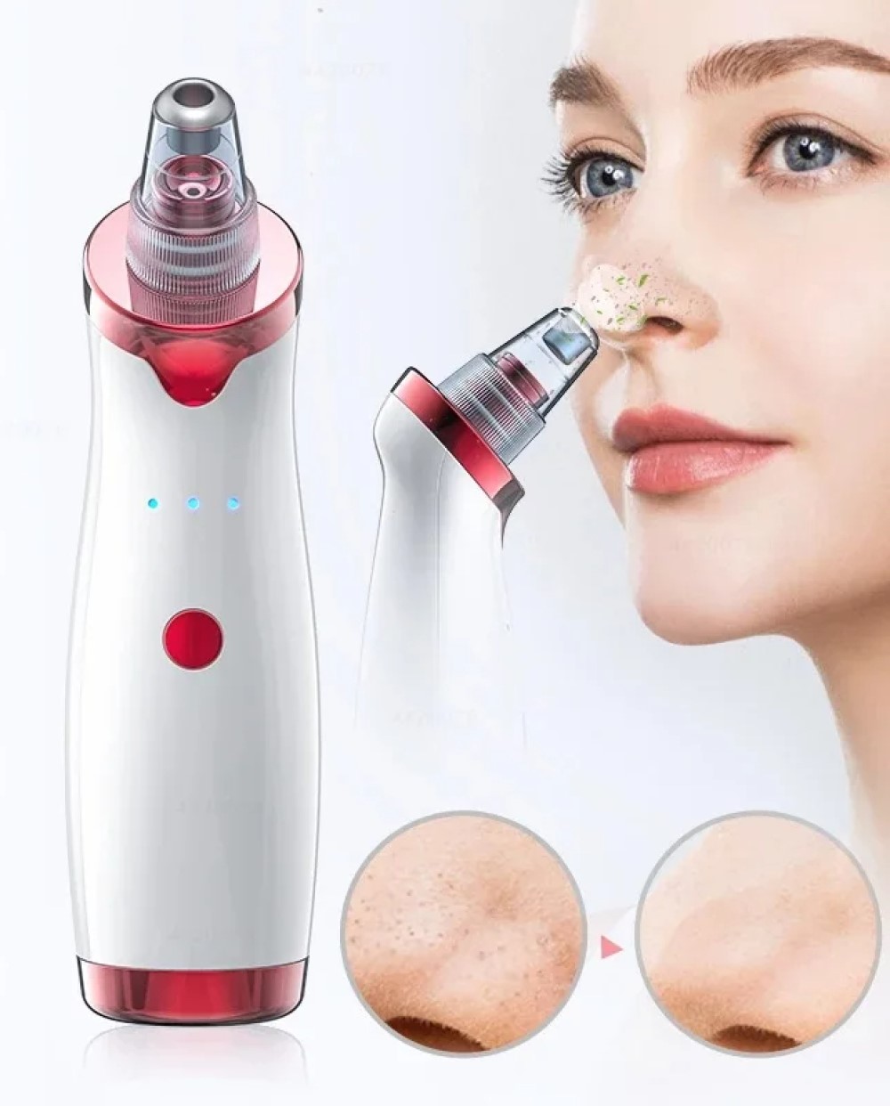 REMOVEDOR PUNTOS NEGROS ESPINILLA LIMPIEZA FACIAL 5EN1 USB - 7