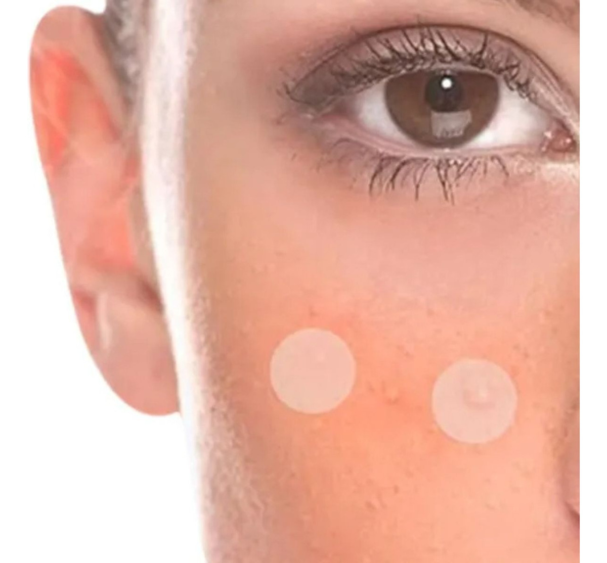 SET 6 PARCHES PARA ACNE HIDROCOLOIDES CICATRIZANTE LAU - 2