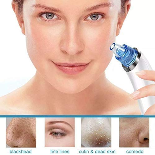 LIMPIADOR FACIAL SUCCIONADOR PUNTOS NEGROS ACNÉ RONDON - 7