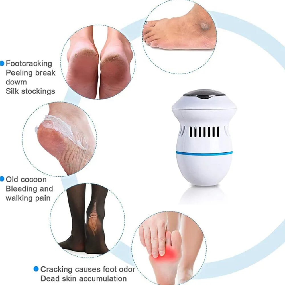 MÁQUINA REMOVEDORA DE CALLOS ELECTRICA LA EMILIANA PARA PEDICURE PROFESIONAL BELLEZA RONDON - 4