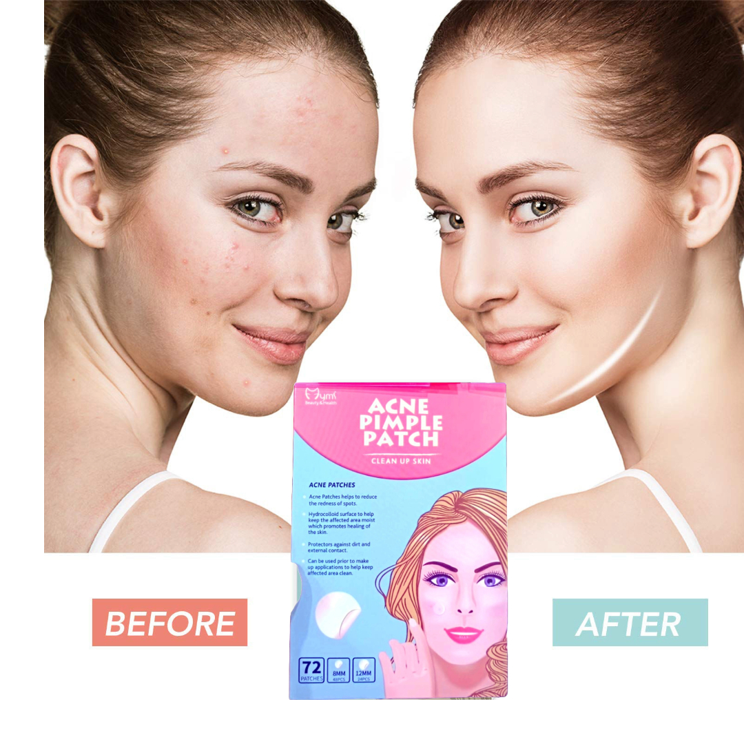 SET 3 CAJAS PARCHE ANTI-ACNE PIEL FACIAL MARCAS LAU - 3