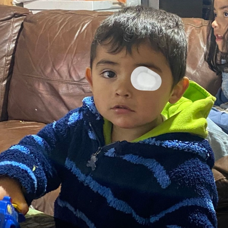 PACK DE PARCHES OCULAR ESTERIL INFANTIL CUIDADO OJOS LAU - 8