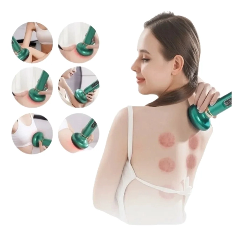 MASAJEADOR VENTOSAS INTELIGENTE TERAPIA MUSCULAR RELAX ALJ - 2