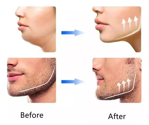 2 EJERCITADOR MANDIBULA CARA MUSCULAR - 3