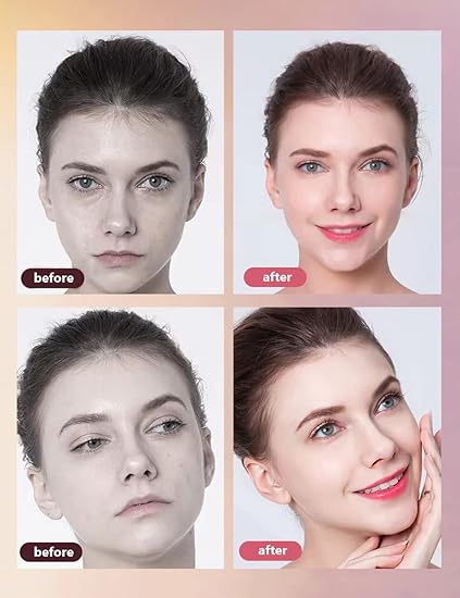 DISPOSITIVO DERMAPEN PARA MESOTERAPIA10 REPUESTOS DE REGALO - 3