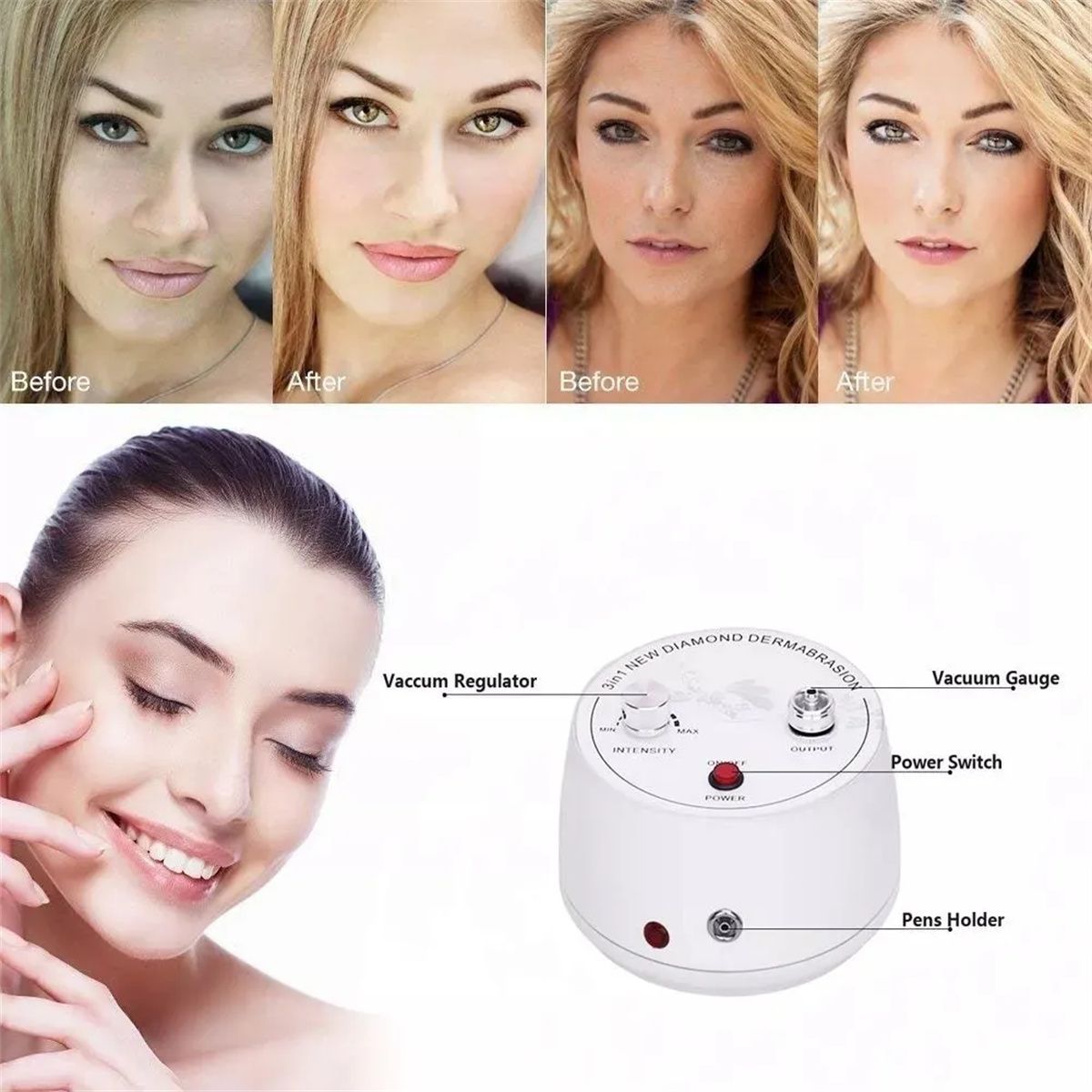 MICRODERMOABRASIÓN PEELING DIAMOND REJUVENECIMIENTO FACIAL - 3