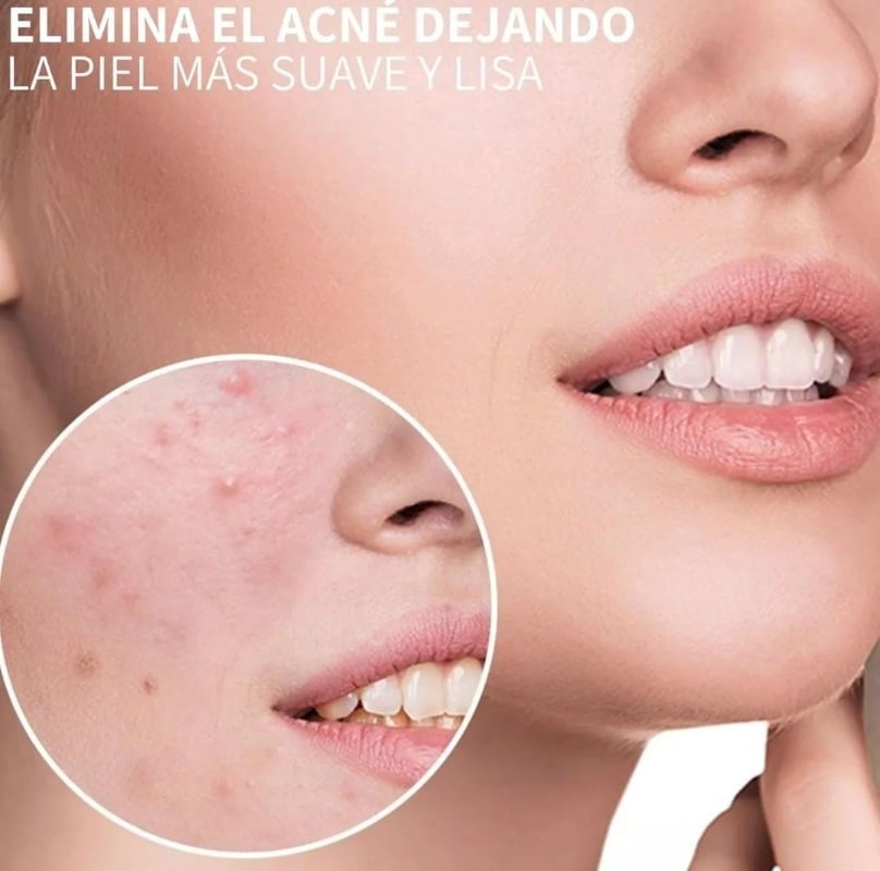 ULTRASONIDO PROFESIONAL 2 EN 1 CORPORAL Y FACIAL 1 A 3 MHZ - 6