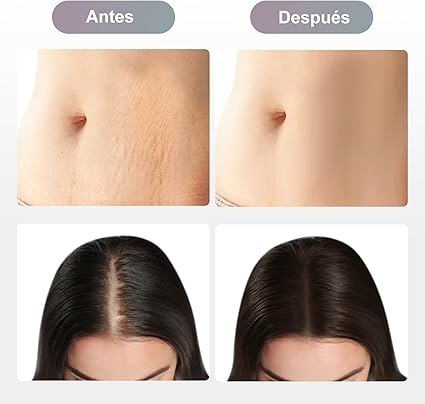 DERMAPEN M8 INALÁMBRICO10 AGUJAS. - 2