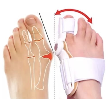 CORRECTOR JUANETES RIQUI ORTESIS HALLUX VALGUS BLANCO - 1