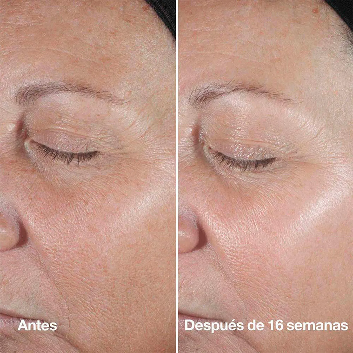 SMART CLINICAL WRINKLE SERUM 100ML - 11