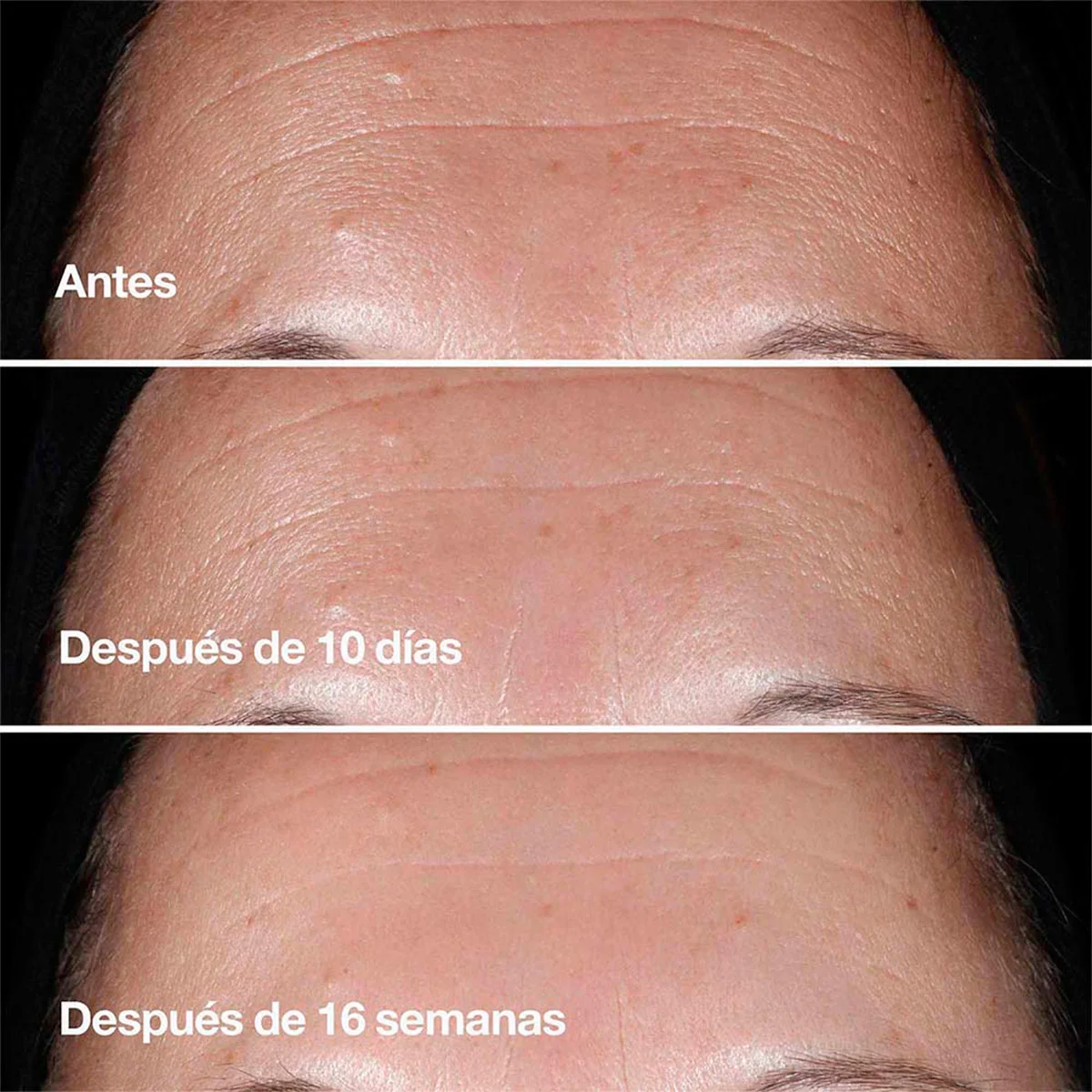 SMART CLINICAL WRINKLE SERUM 100ML - 10