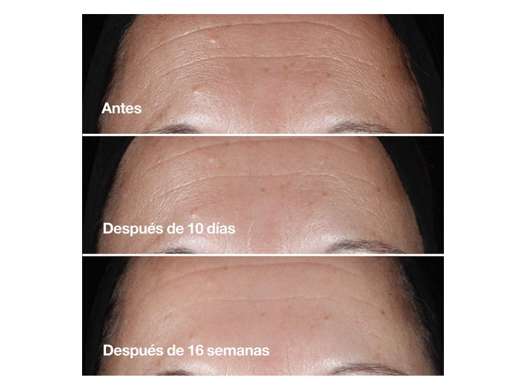 SERUM FACIAL CLINIQUE SMART CLINICAL REPAIR WRINKLE CORRECTING 50 ML - 4