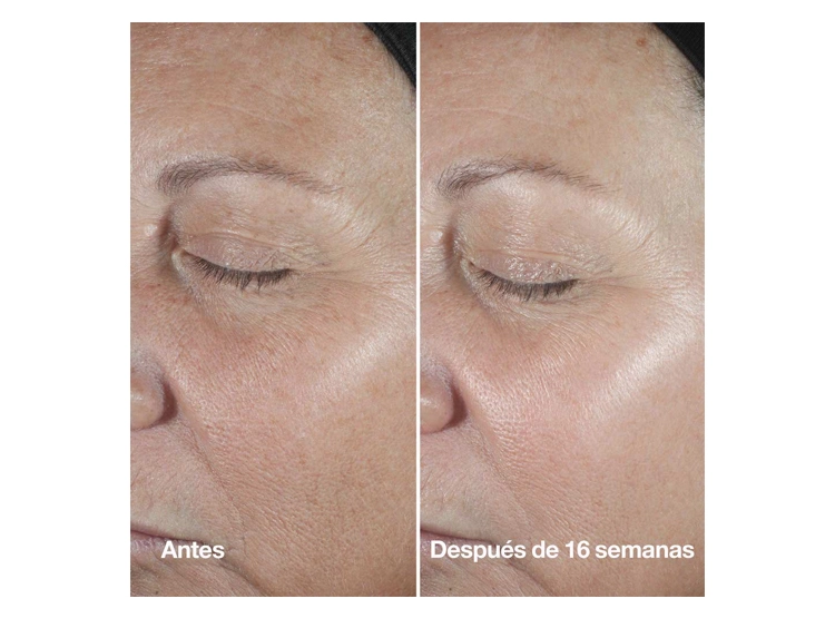 SERUM FACIAL CLINIQUE SMART CLINICAL REPAIR WRINKLE CORRECTING 50 ML - 5