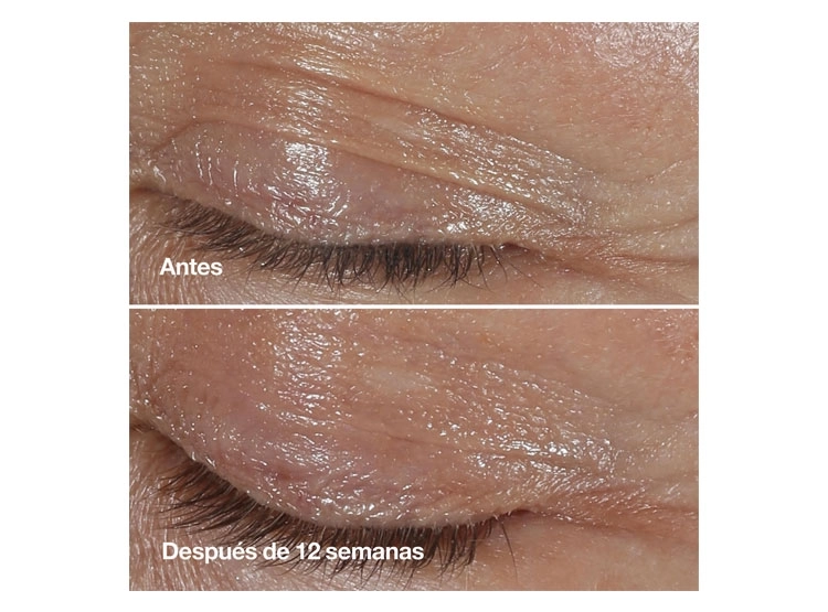 CONTORNO DE OJOS CLINIQUE SMART CLINICAL REPAIR 15 ML - 5