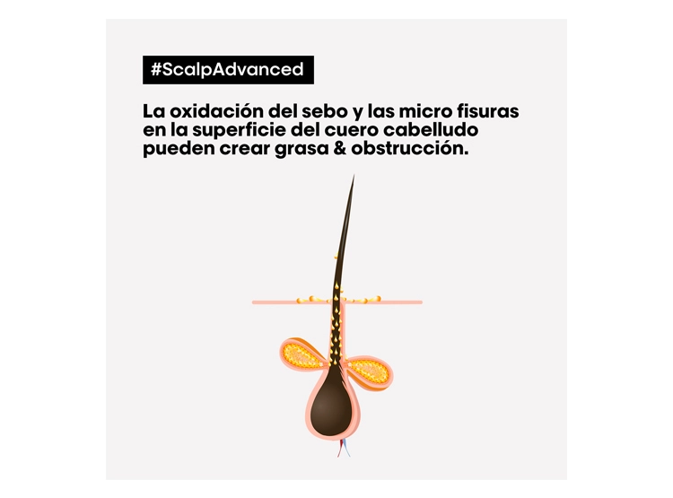 SHAMPOO LOREAL PROFESSIONNEL LIMPIEZA PROFUNDA CABELLO GRASO SCALP ADVANCED 300 ML - 2